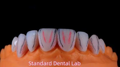 Standard Dental Lab Co., Limited lini produksi pabrikan