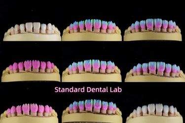 Standard Dental Lab Co., Limited lini produksi pabrikan