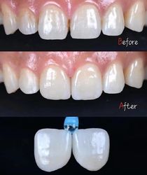 Standard Dental Lab Co., Limited lini produksi pabrikan