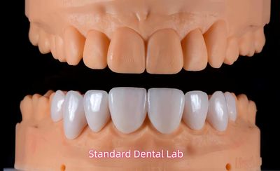 Standard Dental Lab Co., Limited lini produksi pabrikan