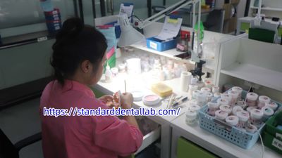 Standard Dental Lab Co., Limited lini produksi pabrikan