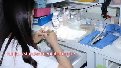 Standard Dental Lab Co., Limited lini produksi pabrikan