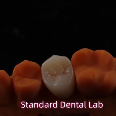 Beli Estatis Tinggi BruxZir Full Contour Zirconia Mahkota Jembatan PFZ pembuatan online