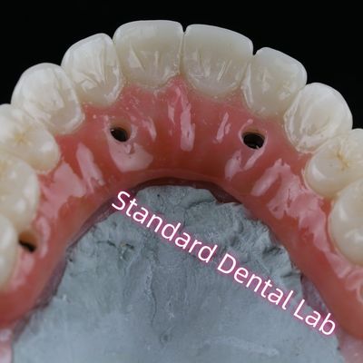 Beli Dental Implant Crown PFZ Porselen berlapis Sekrup Zirconia Dipegang Dengan Permen karet merah muda pembuatan online