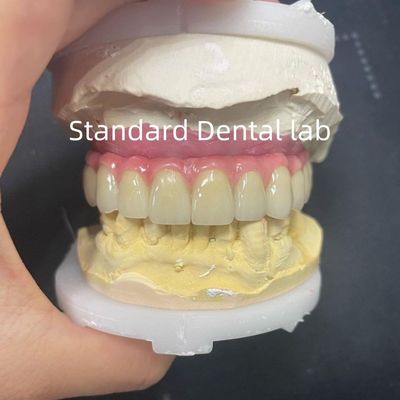 Beli Jembatan Malo Hybrid Zirconia All On Four / Six Zirconia Implant Bridge Titanium Bar pembuatan online