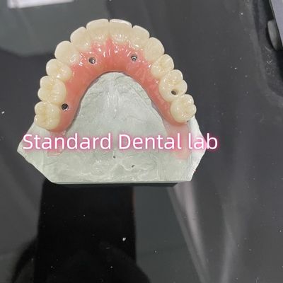 Beli All On Four Six Ivoclar Zirconia Implant Bridge Titanium Bar Dengan Porselen Gum Pink pembuatan online