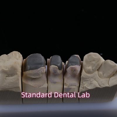 Beli Metal Cast Post Core Crown Cocr Akurat Retentive Full Zirconia Bruxier pembuatan online