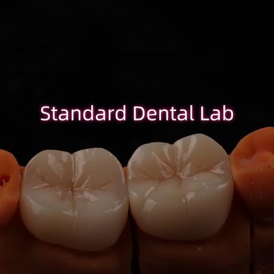 Beli Full Contour Bruxier Monolitik Zirconia Crown Bridge Lab Gigi pembuatan online