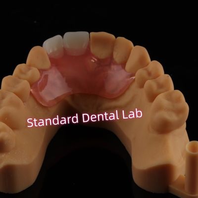 Beli Dental Valplast Fleksibel Flipper Dentures Removable Parsial Denture pembuatan online