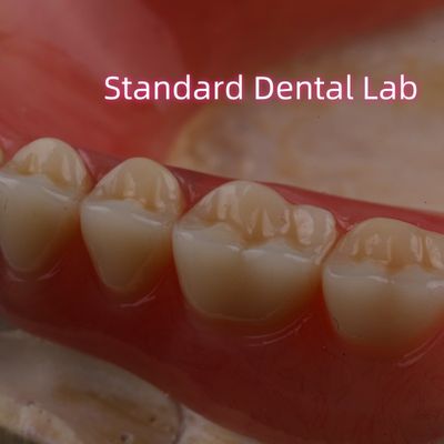 Beli SDL Heat Cured Acrylic Partial Denture Ivoclar Teeth Dental Lab Keakuratan Tinggi pembuatan online