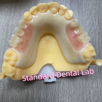 Beli Rangka Acetal Acrylic Clamp Gigi Bagian Yang Dapat Dihapus pembuatan online