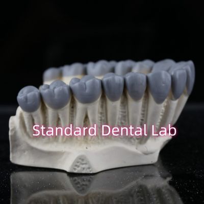 Beli SDL Dental Lab Digital Diagnostic Wax Ups Crown Bridge pembuatan online