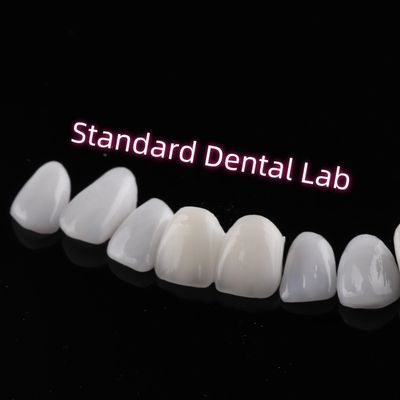 Beli tahan abrasi Emax Zirconia Laminate Veneers Incisal Translucence pembuatan online