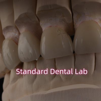 Beli Profesional Lab Gigi Zirconia Mahkota Untuk Restorasi Tetap pembuatan online