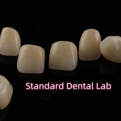 Beli Dental Strong Layered Zirconia Crown Full Upper Arch Restorasi pembuatan online