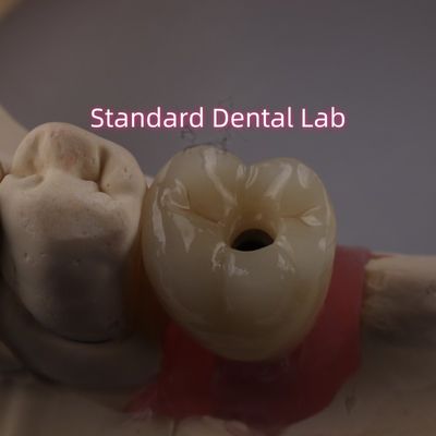 Beli Tulang gigi Implantasi Penangkal Sekrup Crown PFZ Porselen Lapisan Zirconia pembuatan online