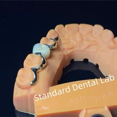 Beli Gigi Gigi PFM Maryland Jembatan Estetika Tinggi FDA Sertifikasi pembuatan online