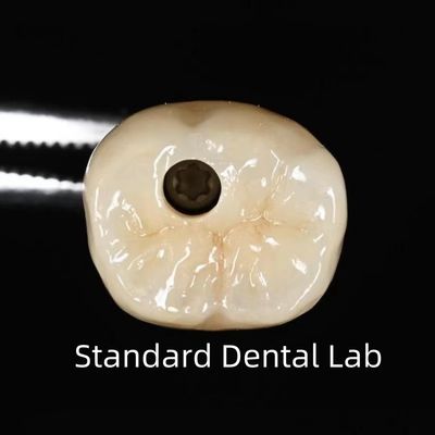 Beli Crown Implantasi Gigi yang Dipegang Sekrup pembuatan online