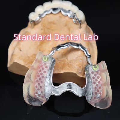 Beli Perlengkapan presisi yang bisa dilepas New Ace Valplast Partial Denture Pink / Dark pembuatan online