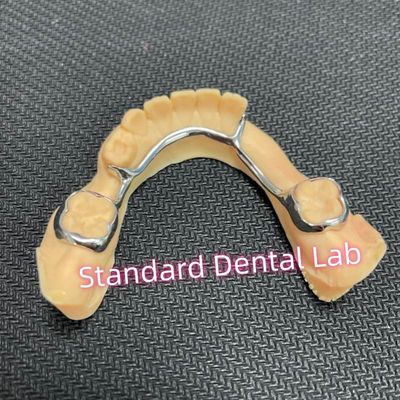 Beli Dental Bilateral Space Maintainer Untuk Gagal Gigi Lingual Holding Arch pembuatan online