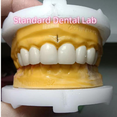 Beli Ivoclar Zirconia Crown Veneers Translucence Tinggi Estetika pembuatan online
