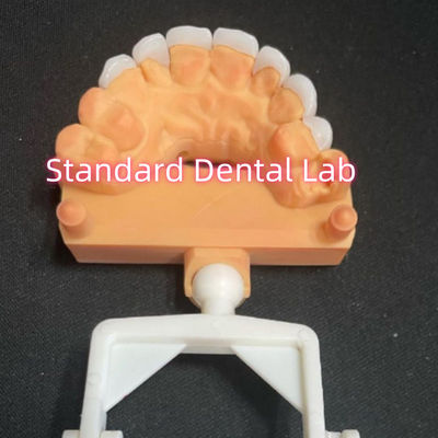 Beli Laminasi Zirconia Emax Benar Ketebalan 0,6mm pembuatan online