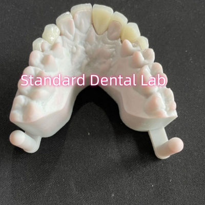 Beli Star's Smile Gigi Gigi Emax Zirconia Laminate Veneers 0,6mm pembuatan online