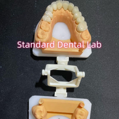 Beli Dental Restoratif Kedokteran Gigi Perawatan mulut Full Zirconia Mahkota Disesuaikan pembuatan online