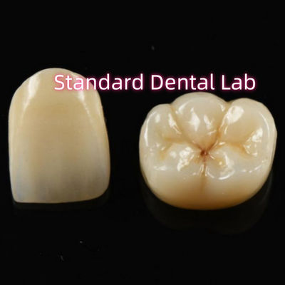 Beli Biokompatibel Material Estetika Zirconia Crown Zirconia Bridge Teeth pembuatan online