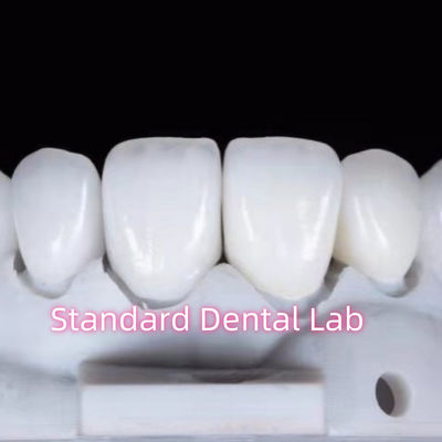 Beli Penyesuaian Penampilan Alami Aidite Dental Zirconia Crown Gigi pembuatan online