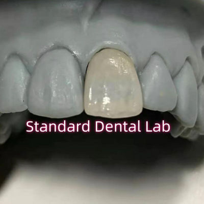 Beli Perawatan Gigi Restoratif Emax Dental Zirconia Porselen Mahkota pembuatan online