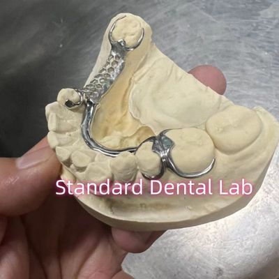 Beli Kerangka rangka Chrome Cast Parsial Denture Metal ISO pembuatan online