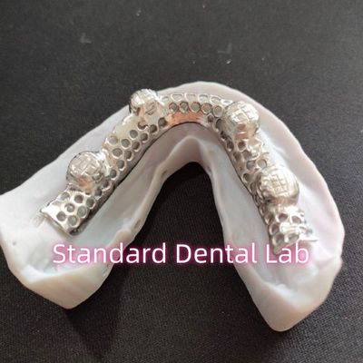 Beli Cast Cobalt Chrome Metal Frame Denture Parsial Dengan Metal Frame pembuatan online