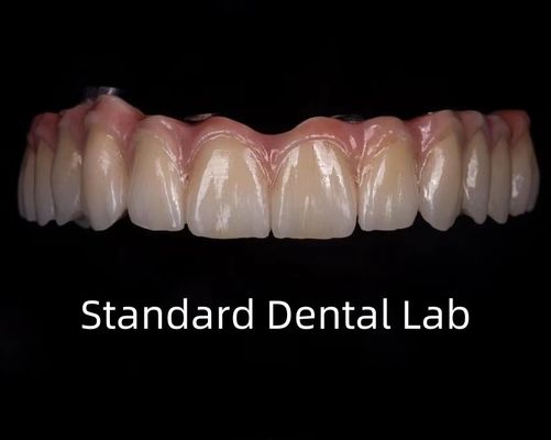 Beli Titanium Full Zirconia Bridge Translucence Gigi Pada Implant Bar pembuatan online