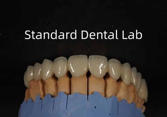 Beli China Dental Lab Metal Keramik Mahkota PFM Mahkota Estetika Tinggi pembuatan online