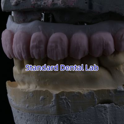 Beli Porselen All On Four Jembatan Zirconia Estetika Tinggi Jembatan Implan Gigi pembuatan online