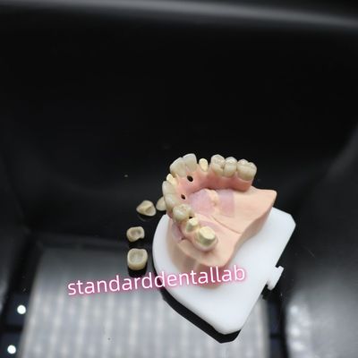 Beli Digital Dental Malo Implant Bridge Titanium Ivoclar Hybrid Zirconia Bridge pembuatan online