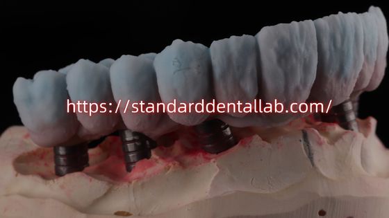 Beli Jembatan Zirconia yang Didukung Implan Dengan Titanium Abutment pembuatan online