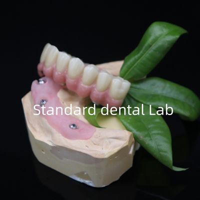 Beli Semua pada 6 Full Zirconia Bridge Dental Tinggi Keakuratan di atas Ti Base pembuatan online