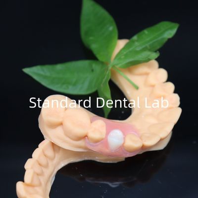 Beli Estetika Valplast Gigi Fleksibel Dengan Kebijakan Redo Gratis Dalam 3 Hari China Dental Lab pembuatan online