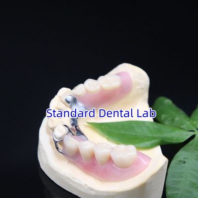 Beli Acrylic Metal Bagian Denture Frame Estetika Tinggi SDL laboratorium gigi pembuatan online