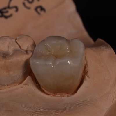 Beli Mahkota Zirconia Translucent Full Contour untuk Hasil yang Menyenangkan pembuatan online
