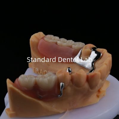 Beli Alloy Metal Parsial Denture Frame 3 Bentuk Exocad Laser Printing Lower Cast Parsial Finish pembuatan online