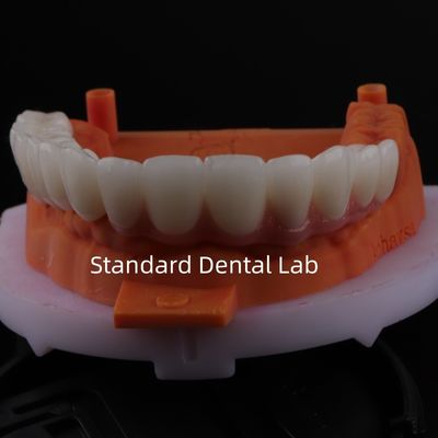 Beli Good Fitting Precise Esthetic Zirconia Porcelain Crown Pink Porcelain Dengan Shade Bleaching pembuatan online