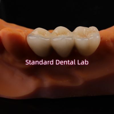 Beli Digital CAD CAM Dental Lab Mahkota Translucent Lapisan Zirconia Mahkota pembuatan online