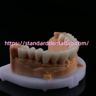 Beli FDA Estetika Tinggi Dental Zirconia Jembatan Dengan Lapisan Porselen Zirconia Dental Mahkota China Dental Lab pembuatan online