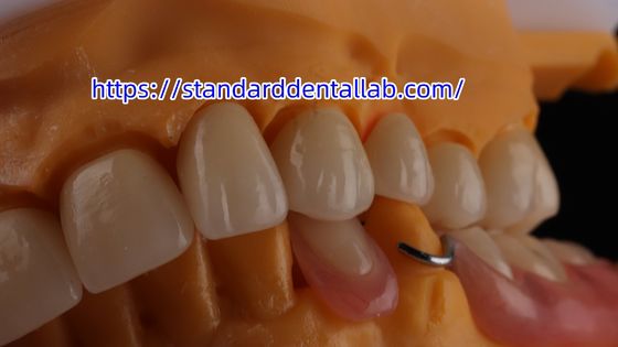Beli Dental berlapis Zirconia mahkota dan jembatan Translucence 3D PRO zirconia porselen mahkota Standard Dental Lab pembuatan online