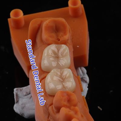 Beli Full Contour Zirconia mahkota tembus pandang 3D PRO Tidak ada Overlay Porselen pembuatan online