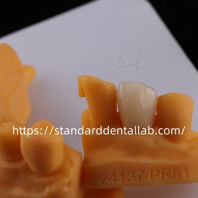 Beli Full Contour Dental Lab Mahkota Translucence Tinggi Solid Zirconia Mahkota China laboratorium gigi pembuatan online