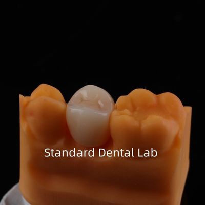 Beli Full Contour Zirconia Crown Kekuatan dan Estetika yang Luar Biasa Tidak Ada Overlay Porselen Corona Belakang Cina Dental Lab pembuatan online
